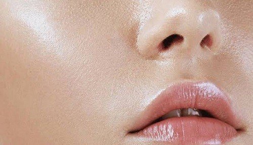 What Causes Oily Skin