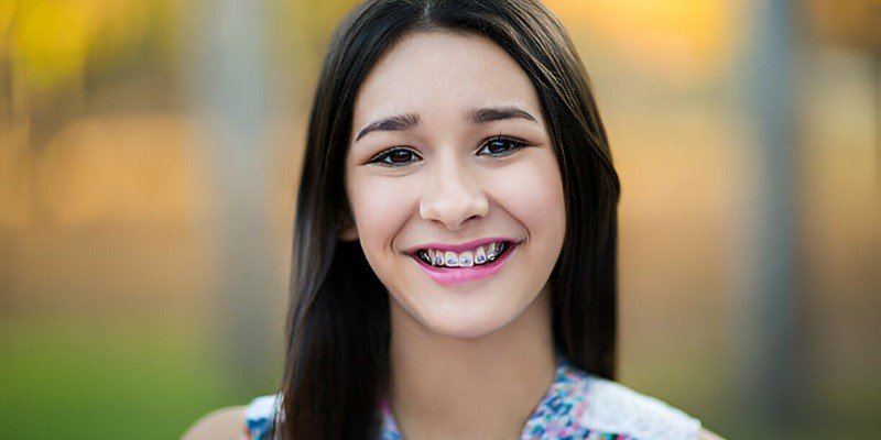 Can You Get Braces With Baby Teeth