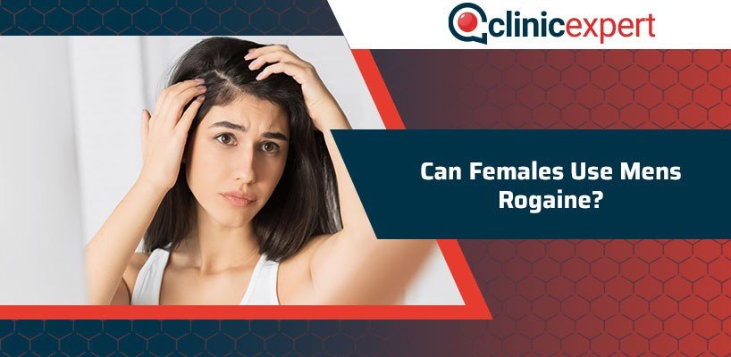 Can Women Use Men'S Rogaine?